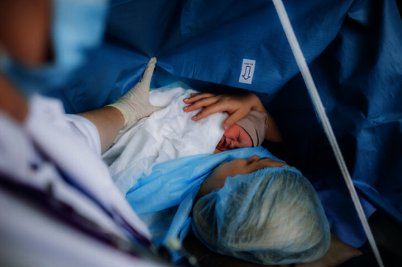 eine Frau hält ihr Baby nach einem Kaiserschnitt. Die Hand einer Ärztin liegt auf dem Rücken des Babys