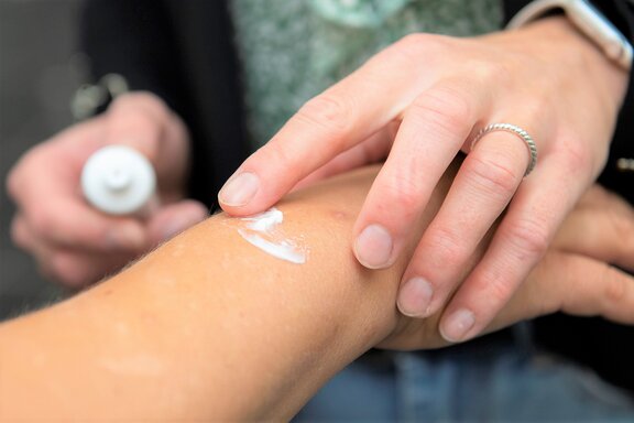 Creme wird auf den Arm eines betroffenen Patienten verteilt