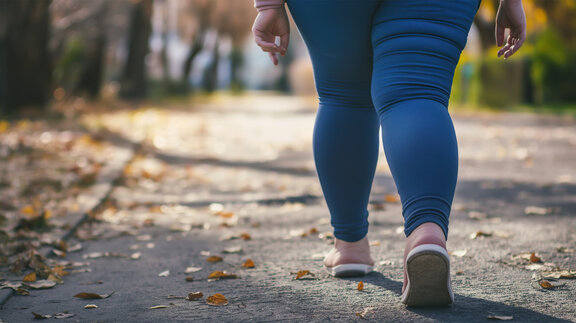 Eine Frau mit einer Lipödem Erkrankung läuft über einen Fußgängerweg. Zu sehen sind nur die Beine der Frau.